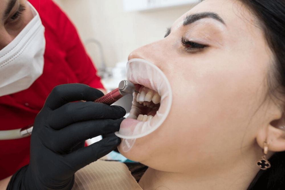 how long do dental sealants last maintenance tips